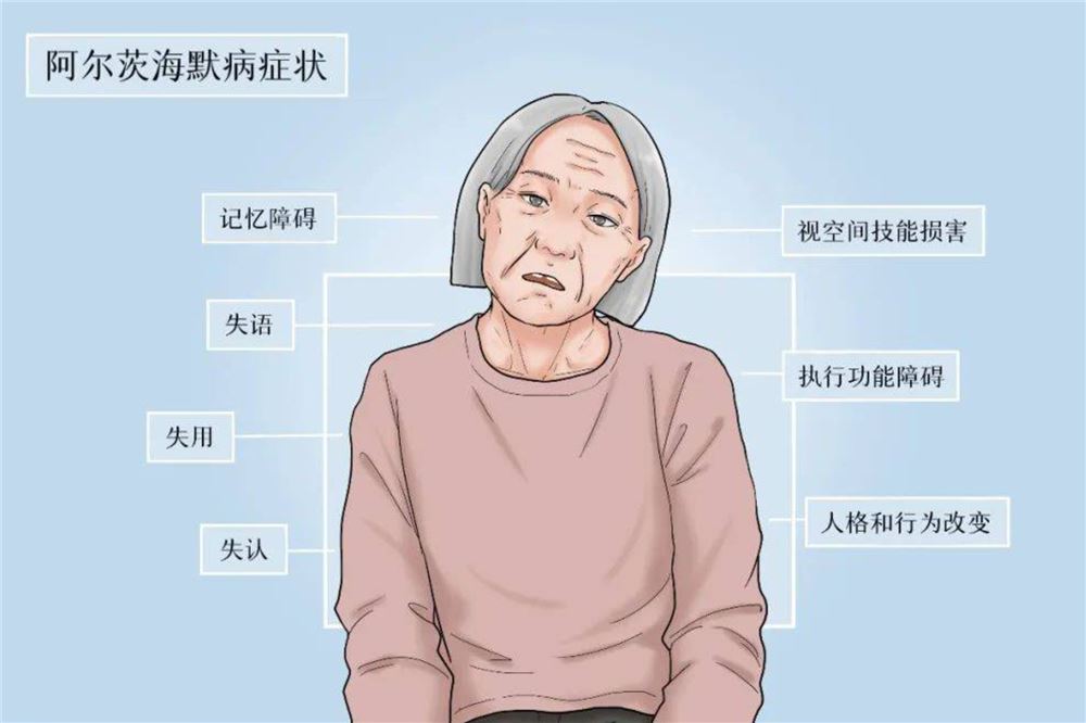 科普｜坚持轻度运动即可预防阿尔茨海默病