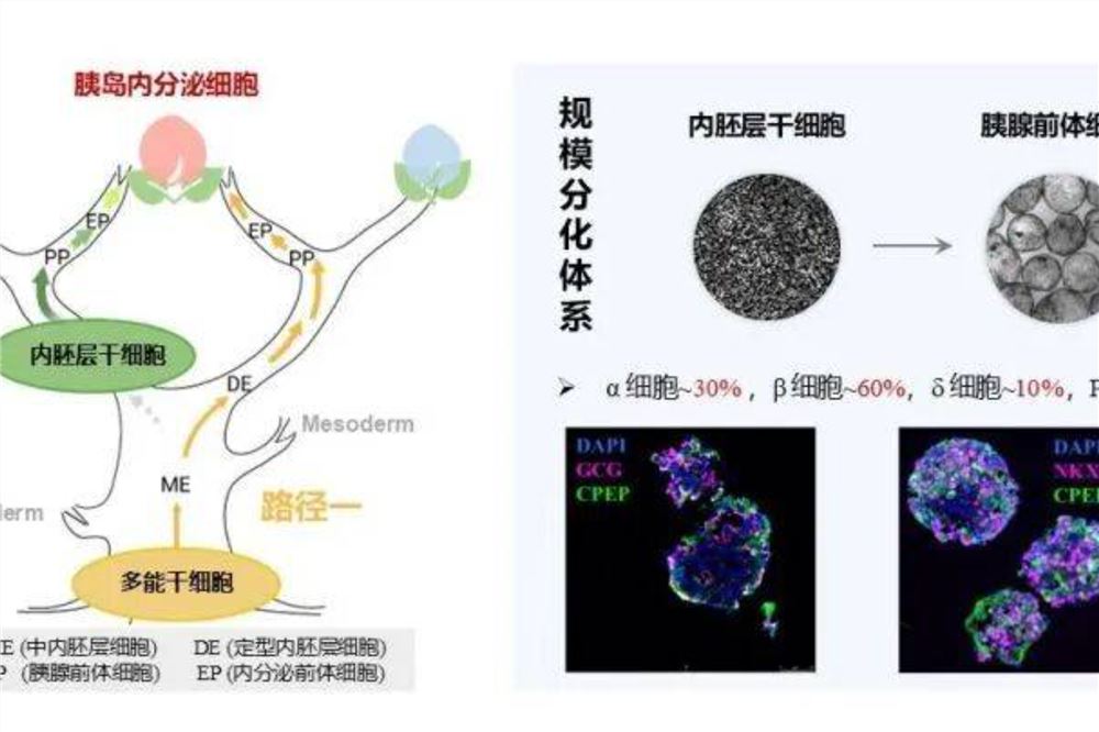 治疗糖尿病，我国科学家取得新突破！