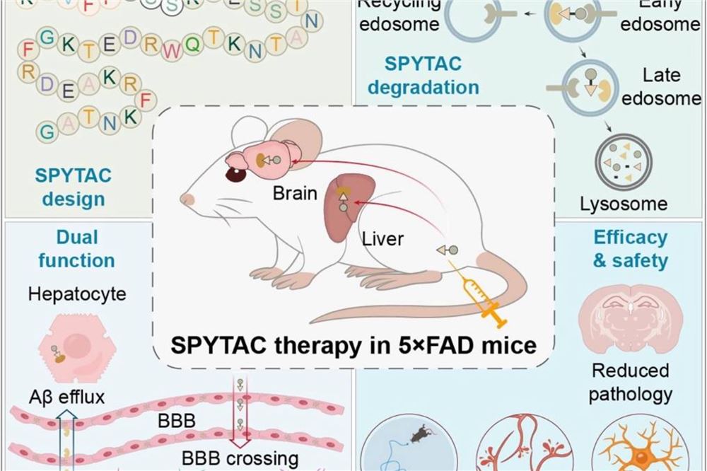 阿尔茨海默病治疗新策略！